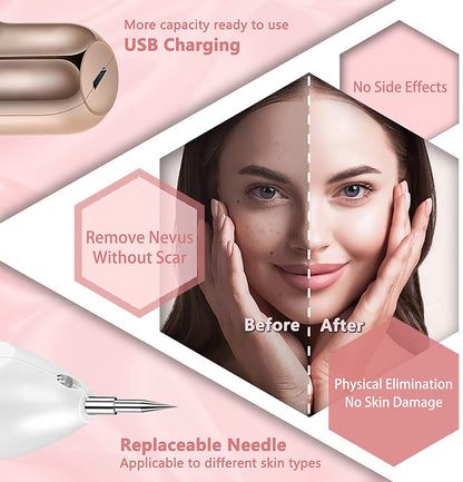 Skin Tag Removal Fibroblast Pen